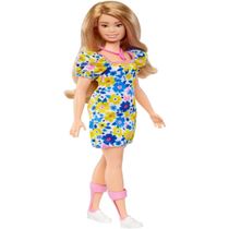 Barbie Loira Síndrome De Down 208 - Mattel